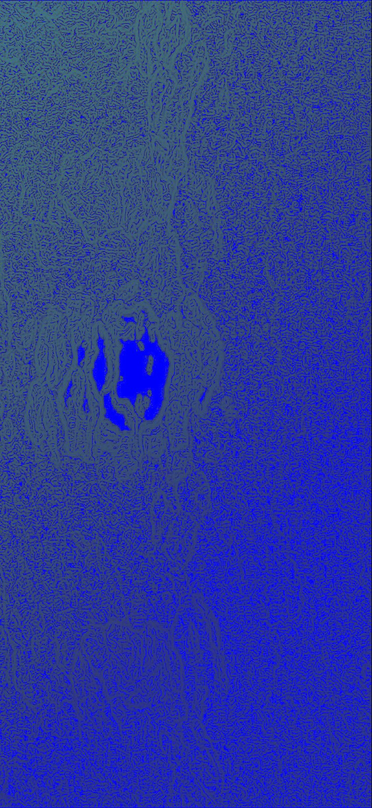 P_20200209_192411_EFF_1_1_2_2_2_1